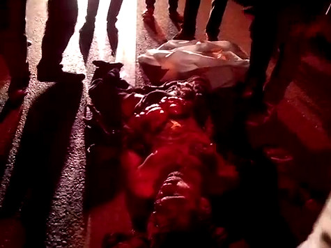 Pedestrian Dead With All Its Innards Exposed