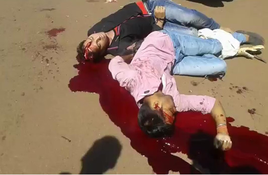 Guy With Smashed Face Still Agonizes Beside His Dead Friend