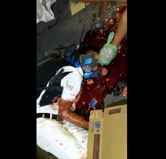 Rider Lies in a Pool Of Blood... People Collect His Brains