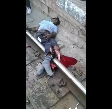 Man got his Legs Cut off at The Train Lines