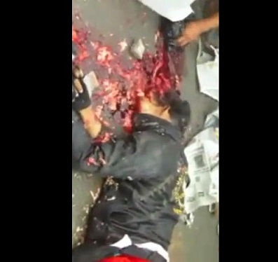 Collect the Scattered Brains of the Dead Motorcyclist in Accident