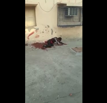 Man Stabbed With Exposed Viscera Agonizes