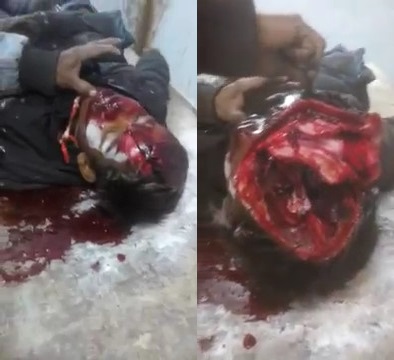 Guy Opens Boy's Head Like a box