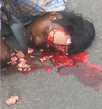 Motorcyclist Died With his Skull Torn to The Street