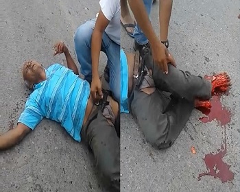 Man in Pain With Feet Ripped Apart