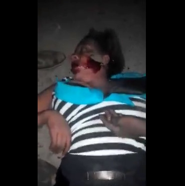 African Woman with Shaven Slit and No Underwear Sexually Assaulted by Multiple Men