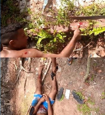 Scared thief gets Fingers Chopped off with a Machete and get a Shot in his Leg