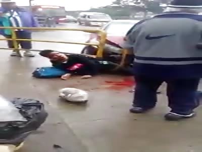 Man in Peru Loses Leg After Pinned by Car Against Railing