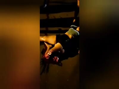 MOTORCYCLE ACCIDENT (BEFORE AND AFTER)