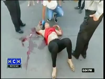 WOMAN CRITICALLY INJURED AFTER BEING SHOT