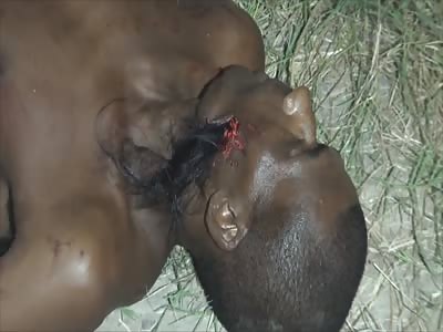 RIFLE SHOOT TAKE OUT WOMAN HAIR AND MADE A HOLE IN DUDE'S FACE