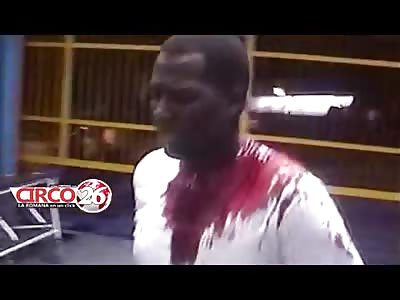 MAN CALMLY WALKS INTO HOSPITAL WITH KNIFE BURIED IN HIS SKULL