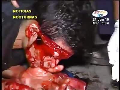 BRUTAL MACHETAZO IN THE FACE (MACHETAZO EN LA CARA)