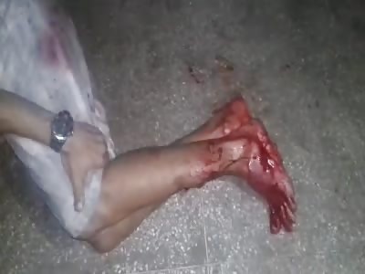 HOW DOES IT FEEL TO BE SHOT BY A BULLET?