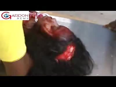 WOMAN SUFFERS DEEP CUT IN THE HEAD