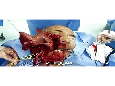 SHOCKING FACIAL SURGERY