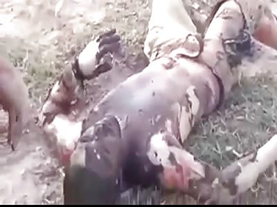 BURNED IN ACCIDENT: MAN IS WAITING FOR MEDICAL CARE IN TOTAL AGONY