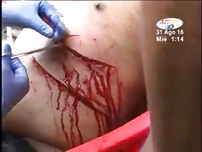 MAN WAS WOUNDED IN STRUGGLE FOR THE LOVE OF A WOMAN