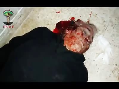 THE ELDERLY WOMAN'S HEAD