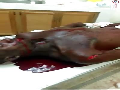 MAN WAS SERIOUSLY INJURED DURING MACHETE FIGHT