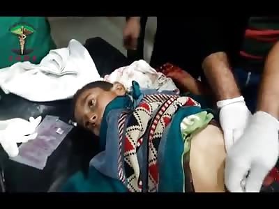 BOY INJURED BY BOMB SHRAPNEL