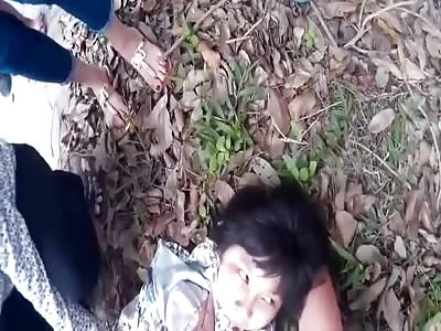 GIRL CONVULSING AFTER  ACCIDENT WITH SCOOTER