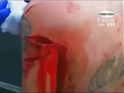 MAN WAS INJURED BY MACHETAZOS