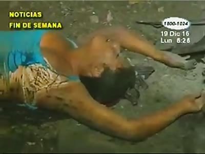 GIRL DIES HIT BY HIGH VOLTAGE POLE AFTER A CAR ACCIDENT