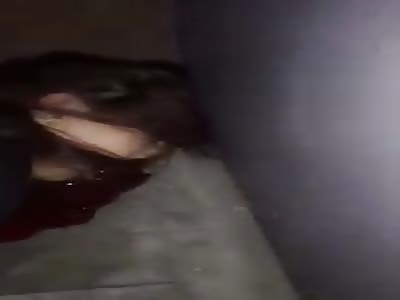 DYING GIRL AFTER ISTAMBUL TERRORIST ATTACK