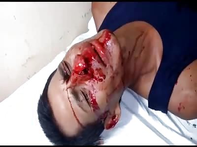 MAN INJURED BY MACHETE