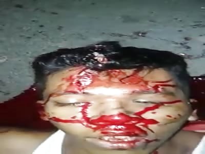 HE BROKE THE HEAD IN AN ACCIDENT