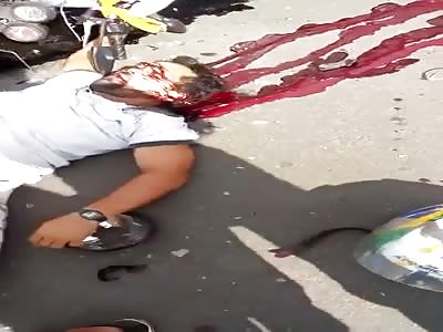 SHOCKING AFTERMATH OF AN ACCIDENT - III