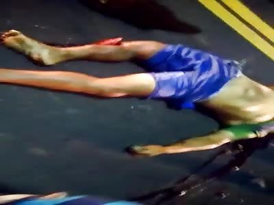 EXPOSED FRACTURE: MAN DEAD ON THE ROAD