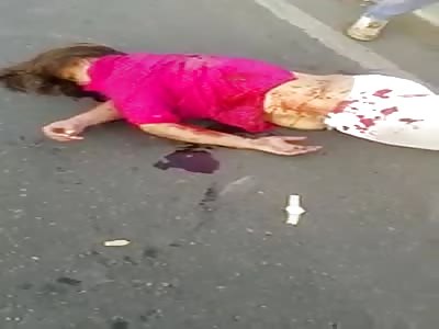 WOMAN DYING AFTER ACCIDENT