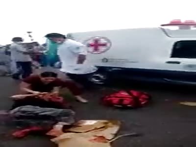 EXTREMELY FUCKED UP LEG AFTER ACCIDENT