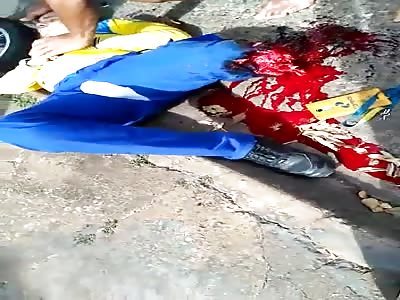 SHOCKING: POSTMAN LOSES LEG IN ACCIDENT