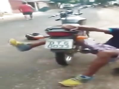 MAN'S LEG IS STUCK IN THE MOTORCYCLE WHEEL
