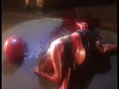 MAN IS ALIVE BUT YOU CAN SAY THAT HIS LEG IS FUCKING DEAD