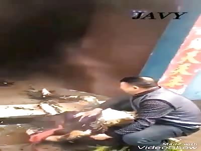 GIRL BURNED IN ACCIDENT