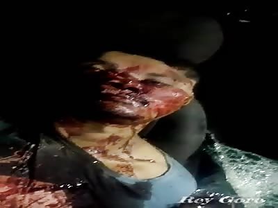 FLATTENED HEAD IN AN ACCIDENT