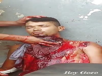 WORK ACCIDENT - ANOTHER ANGLE