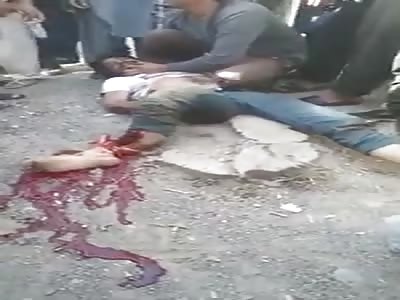 MAN LEG TOTALLY FUCKED UP