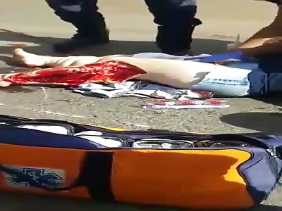 WOMAN SCREAMS IN PAIN AFTER ACCIDENT