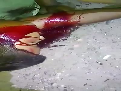 12 YEARS-OLD BOY HIT BY BUS