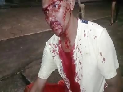 MAN DYING IN FRONT OF CAMERA