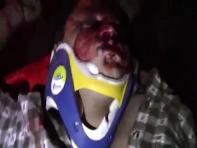 VICTIM OF MOTORCYCLE ACIDENT