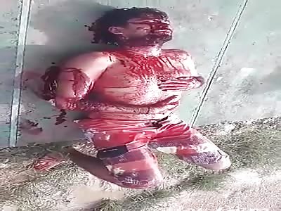 MAN INJURED BY MACHETE, COVERED WITH BLOOD