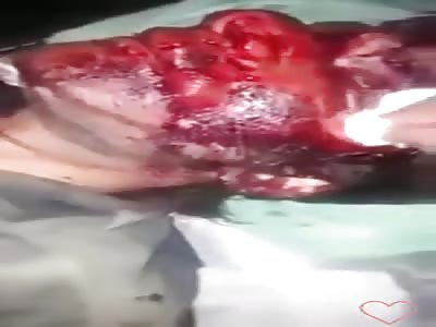 PEOPLE SERIOUSLY WOUNDED