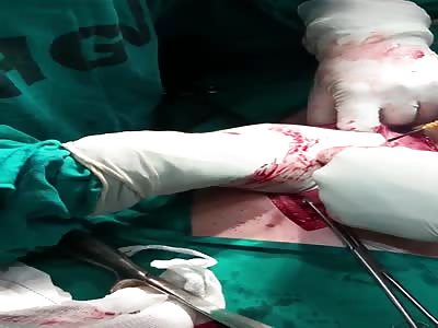 THIS IS A VERY, VERY WEIRD THING