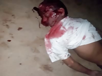 HE GOT SHOT IN THE FACE